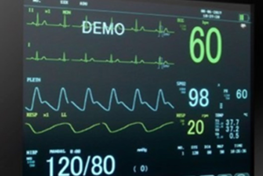 Großaufnahme EKG-Monitor mit Anzeige